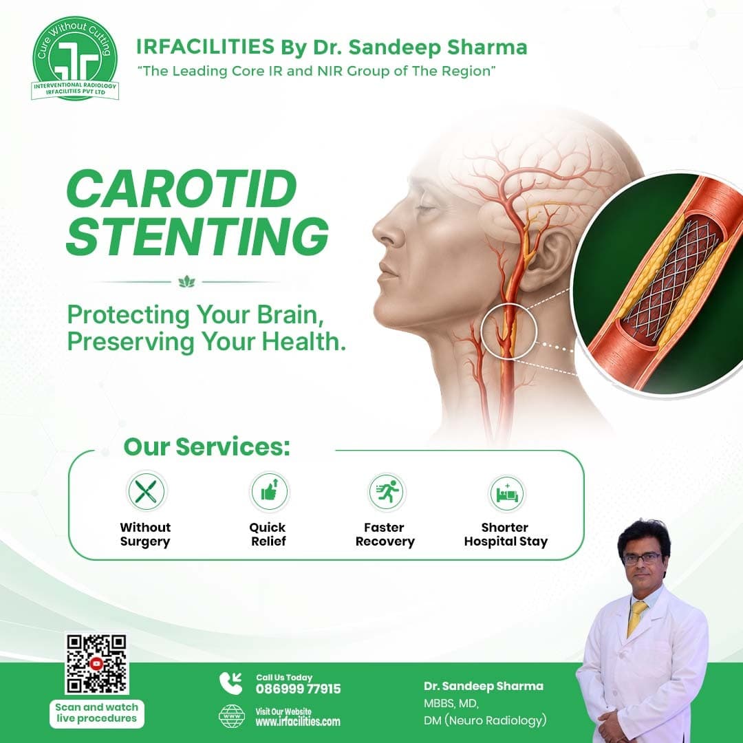 Carotid Stenting Treatment | Preventing Stroke Through Image Guided Procedures