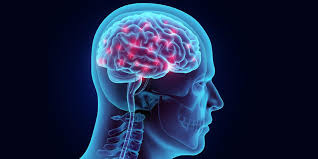 Brain Hemorrhage Operation | Expert Neurointerventional Treatment | IRFacilities
